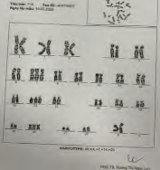 Siêu âm bất thường 1